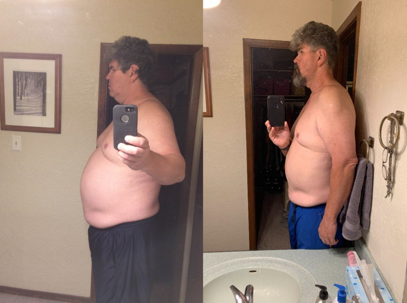 Don — before and after
