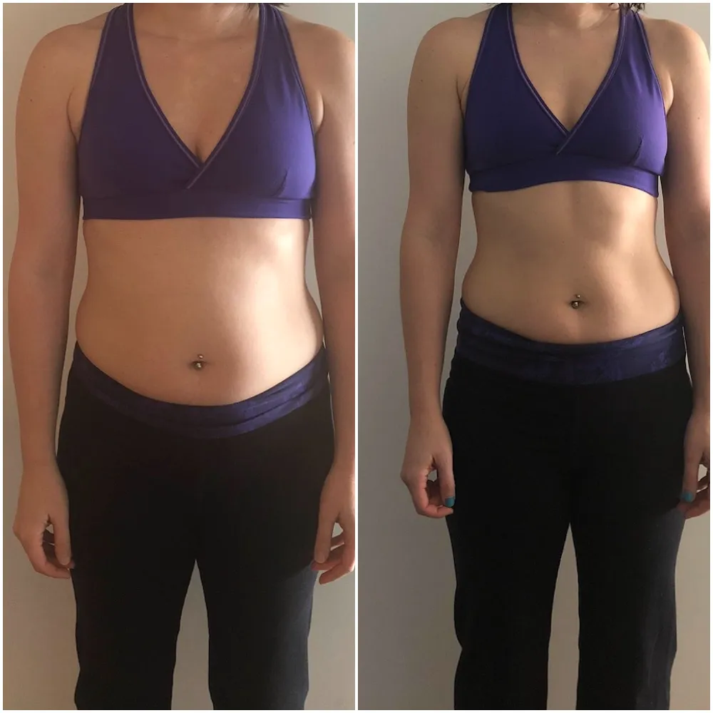 Nancy — before and after